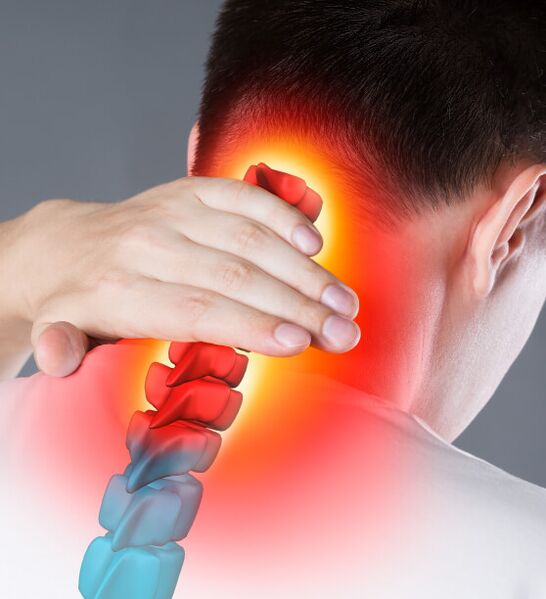 Simptomi osteohondroze materničnega vratu