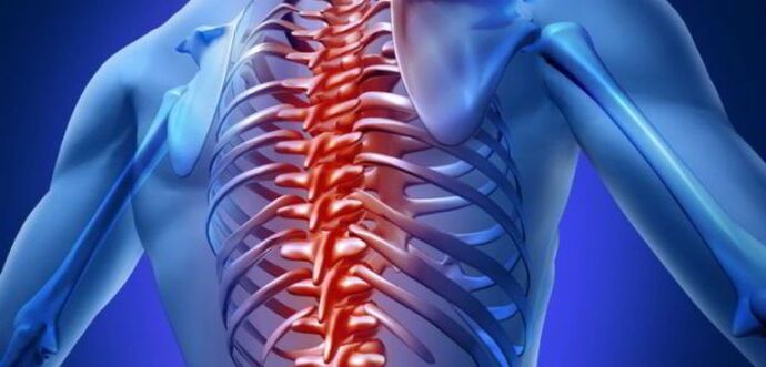 osteohondroza torakalne hrbtenice